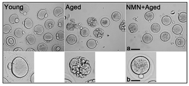 young, aged and NMN aged eggs