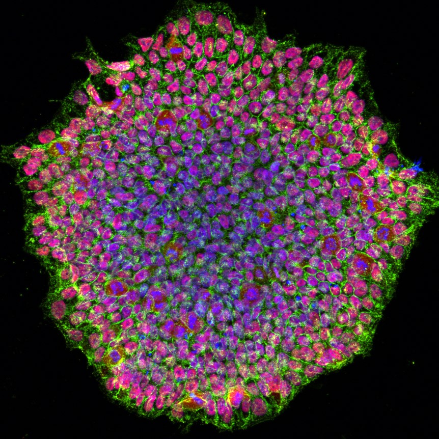 Yamanaka factors and induced pluripotent stem cells