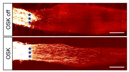 Vision regeneration. Optic nerve regeneration