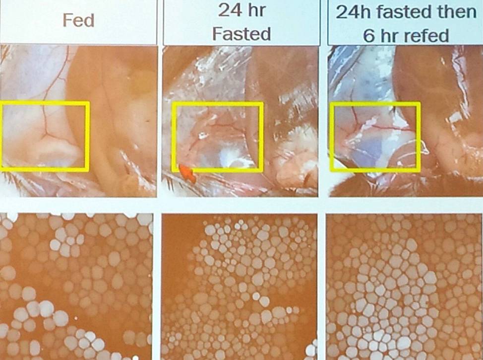 Intermittent fasting and tissue remodeling