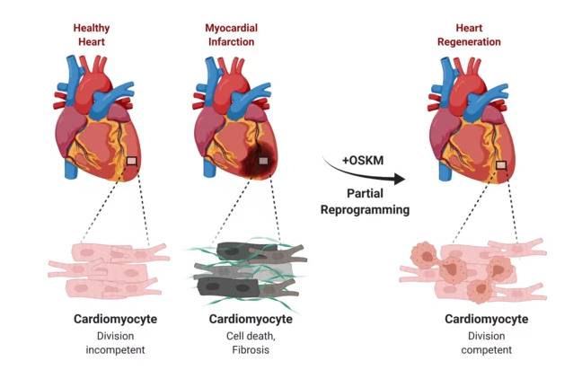 yamanaka factors and heart regeneration and repair after infarction