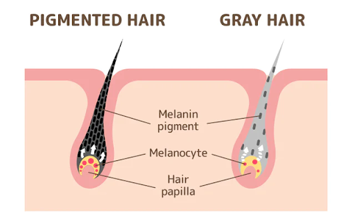Gray hair reversal, hair pigments and melanin